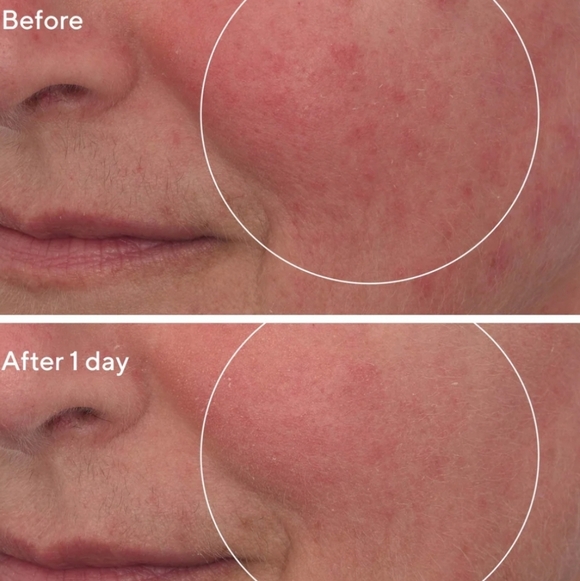 Murad Hydration Cellular Hydration Repair Mask, 10ml (Travel Size), NIB - Picture 5 of 5